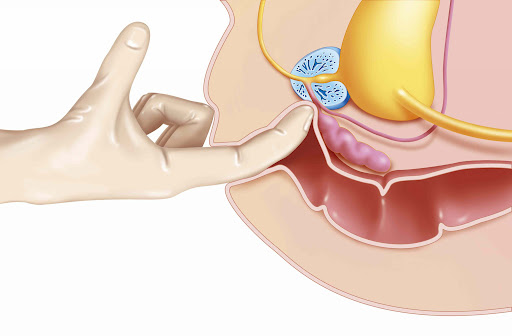 Kích thích hậu môn và tuyến tiền liệt nam bằng tay